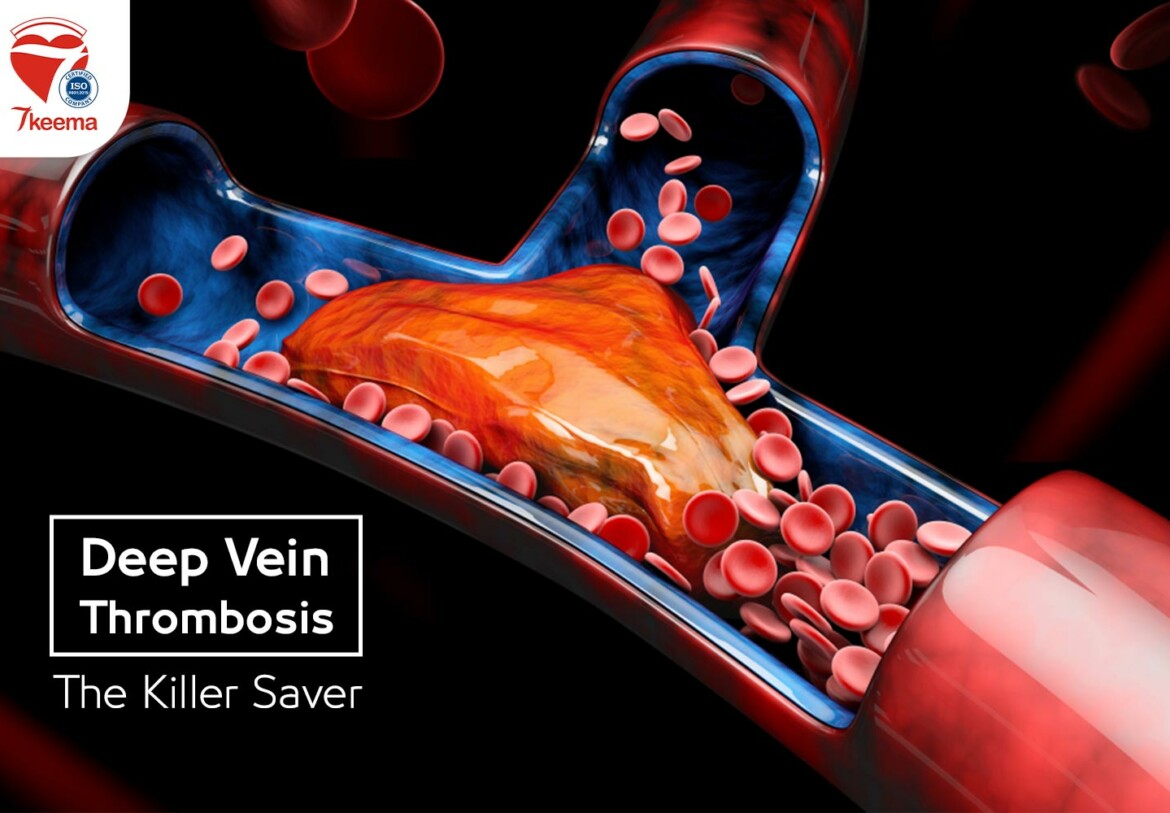 Deep Vein Thrombosis, The Killer Saver
