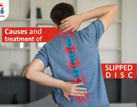 Get to know more about the herniated disc, its causes & treatment.