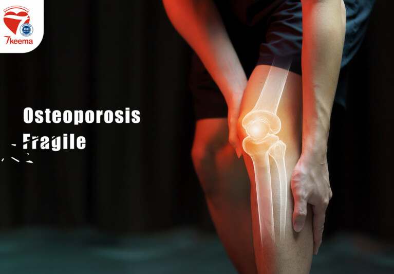 Osteoporosis Symptoms & Treatments Fragile