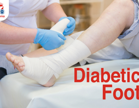 What you need to know about Diabetic Foot Care