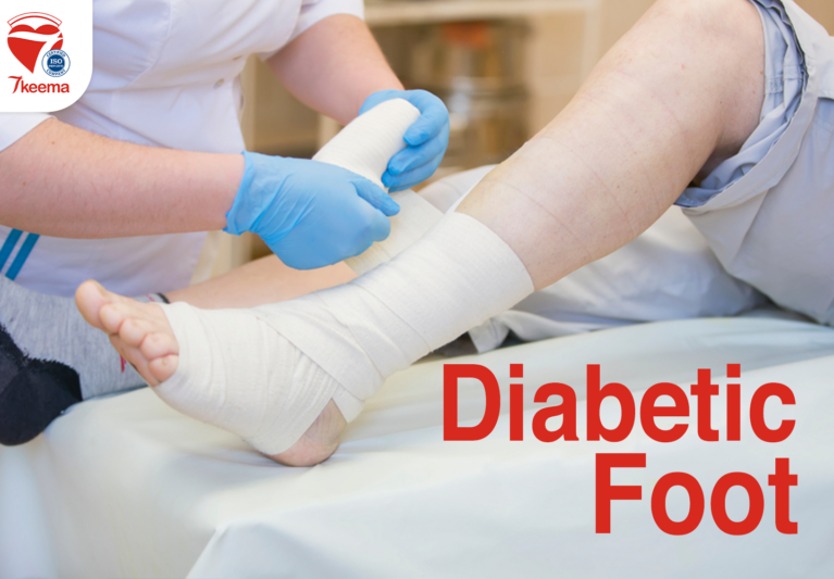 What you need to know about Diabetic Foot Care