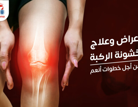  أعراض وعلاج خشونة الركبة، من أجل خطوات أنعم