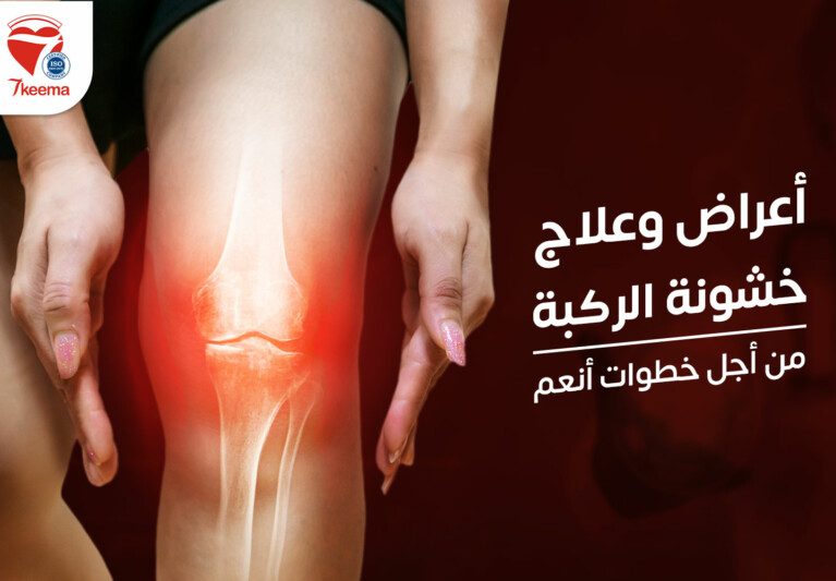  أعراض وعلاج خشونة الركبة، من أجل خطوات أنعم